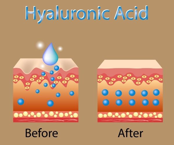 How effective is Hyaluronic Acid