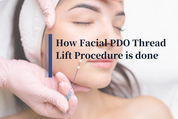 Facial thread lifts procedure